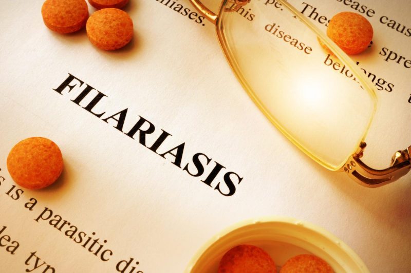 Filariasis- Lymphatic filariasis, symptoms and treatment